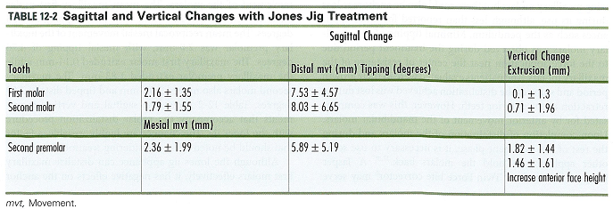 درمان ارتودنسی با جونز جیگ