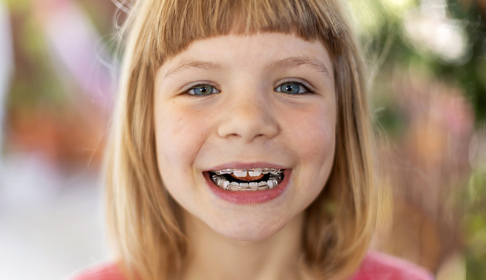 طفلة صغيرة تستفيد من علاج تقويم الأسنان المبكر