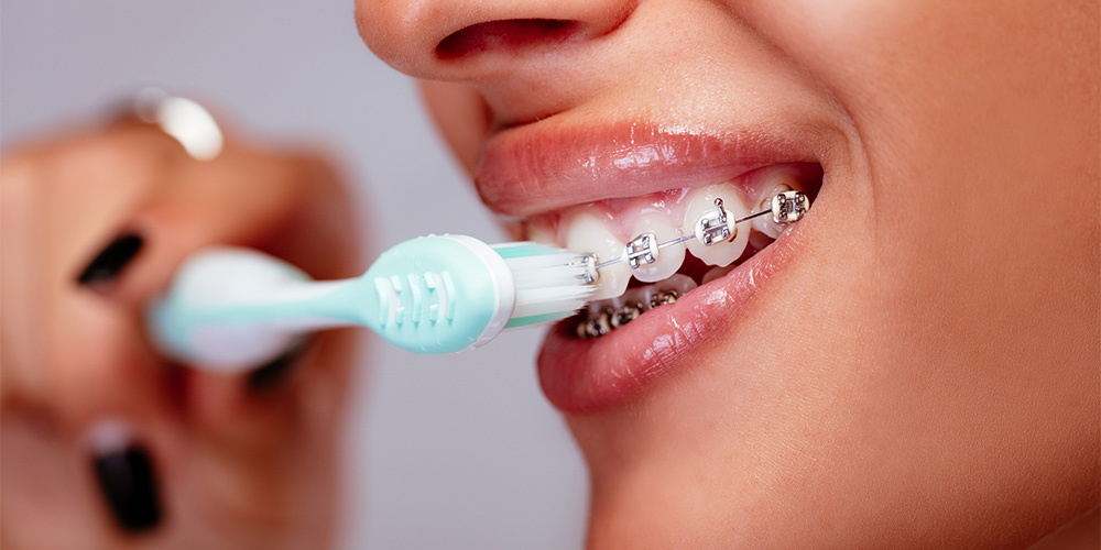 a woman brushing her teeth with brakets