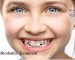 لماذا العلاج المبكر بتقويم الاسنان