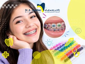 ارتودنسی رنگی روی دندان های دختر