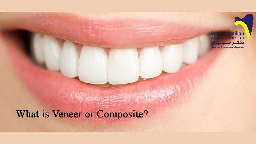 What is a Veneer or Composite? Dr Jamilian