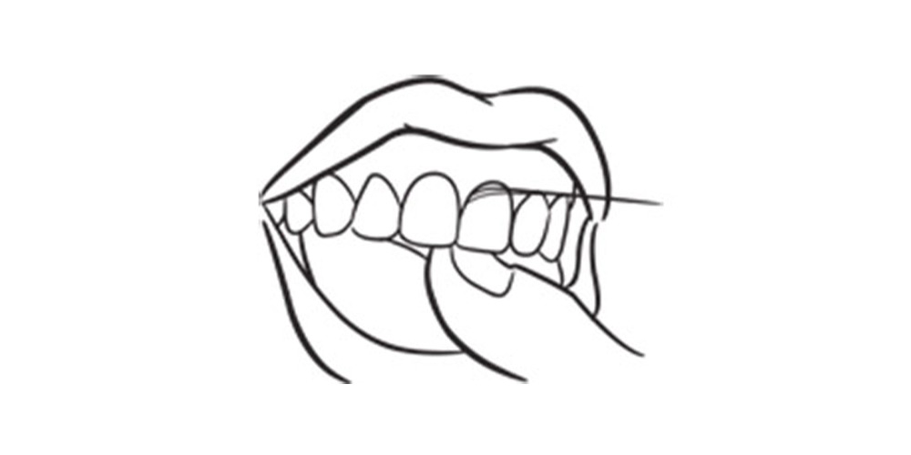 حرکت منظم نخ دندان بین دو دندان جلویی