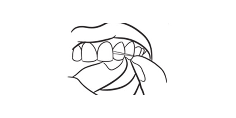 استفاده از نخ دندان بین دو دندان شماره یک و دو