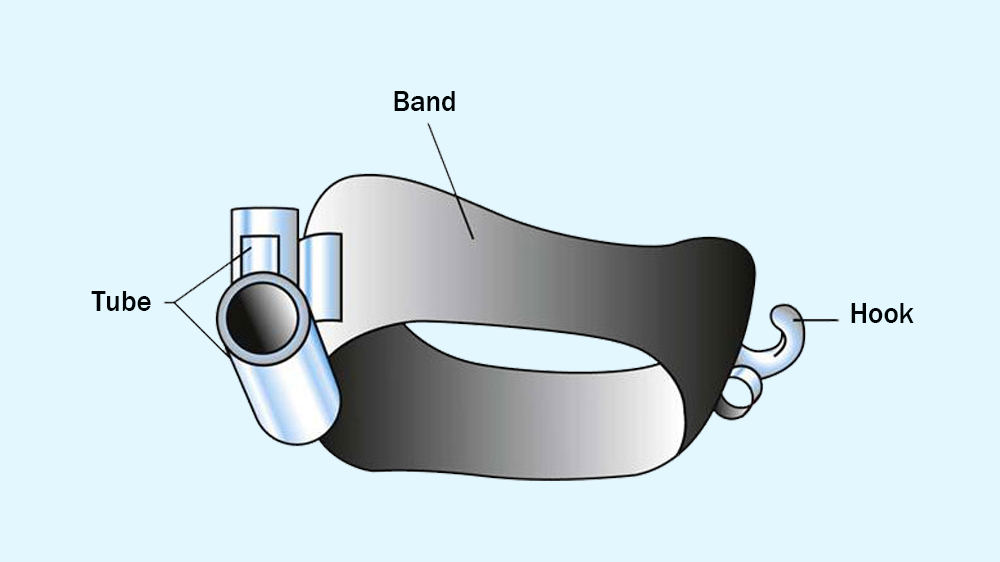 orthodontic band components