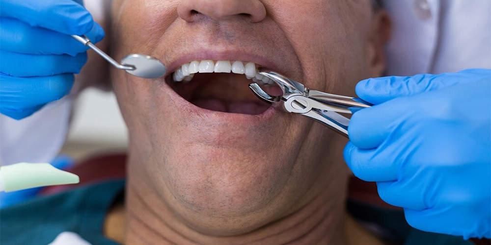 مردی در حال کشیدن دندان هایش