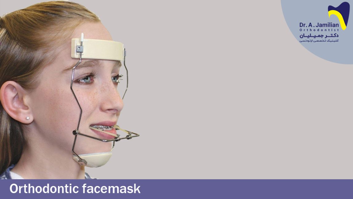 Orthodontic Facemask Dr Jamilian