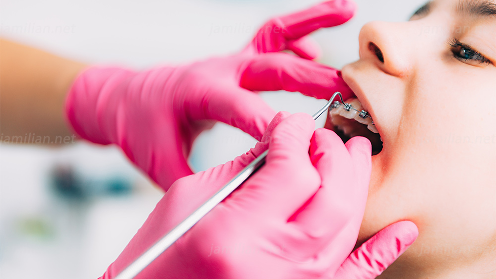 متخصص ارتودنسی در حال معاینه کردن براکت دندانی دختر