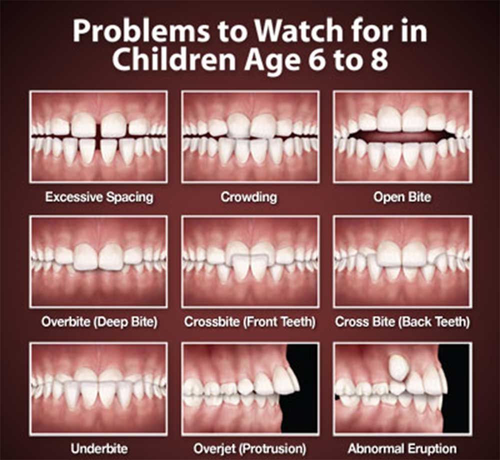 ناهنجاری های دندانی کودکان