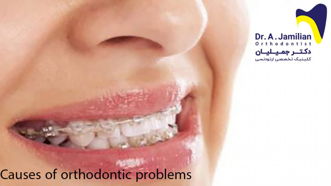 Causes of orthodontic problems Dr Jamilian