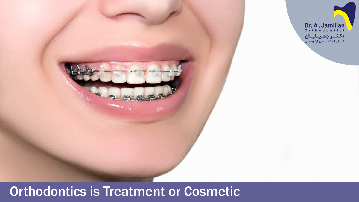 Orthodontics is Treatment or Cosmetic - Dr jamilian