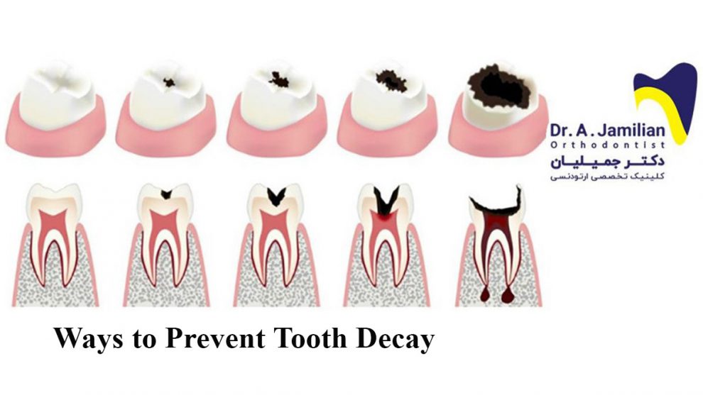 This Secret Habit Protects Against Tooth Decay - lkx6xpu