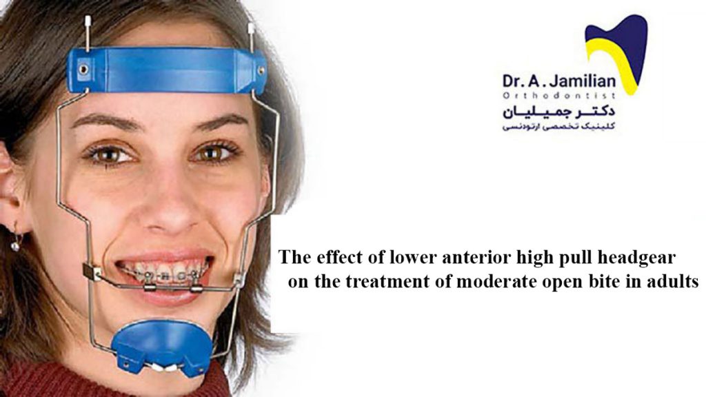 Orthodontic articles Dr Jamilian Orthodontist