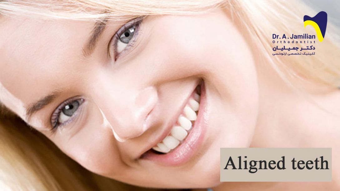 Aligned teeth - Dr Jamilian