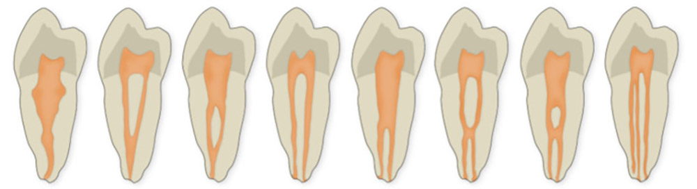 هشت مدل از انواع ریشه دندان