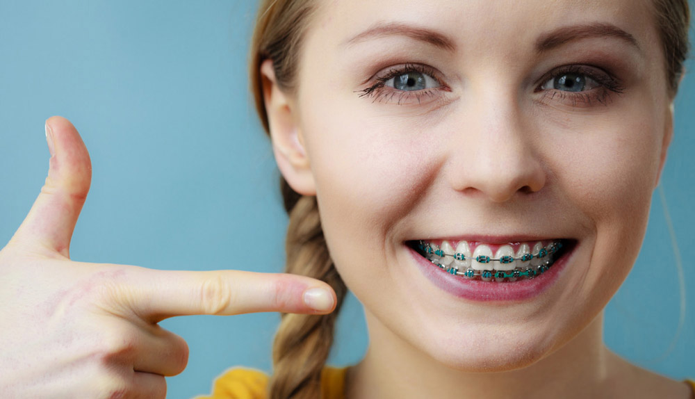 Ein Mädchen, das auf ihre Zähne zeigt und zeigt, was die Kieferorthopädie für sie getan hat