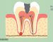 آناتومی دندان انسان