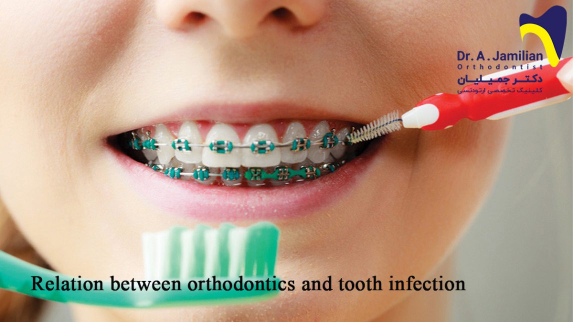 Relation Between Orthodontics And Tooth Infection Dr Jamilian