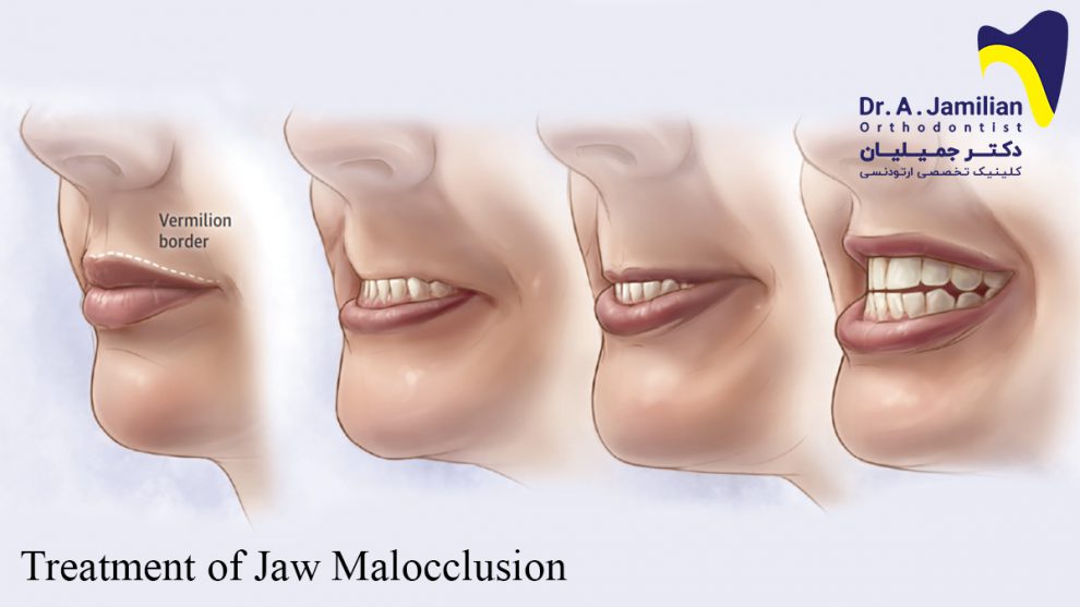 Symptoms of maxillofacial malformations Dr. Jamilian