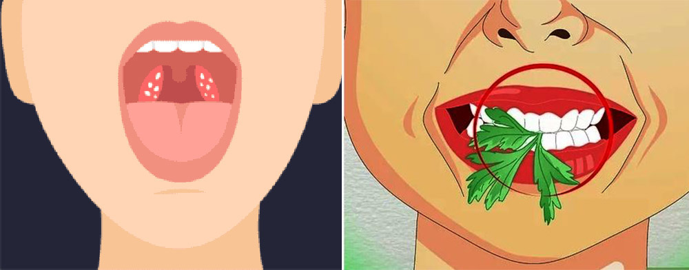 درمان بوی بد دهان با رژیم غذایی سالم