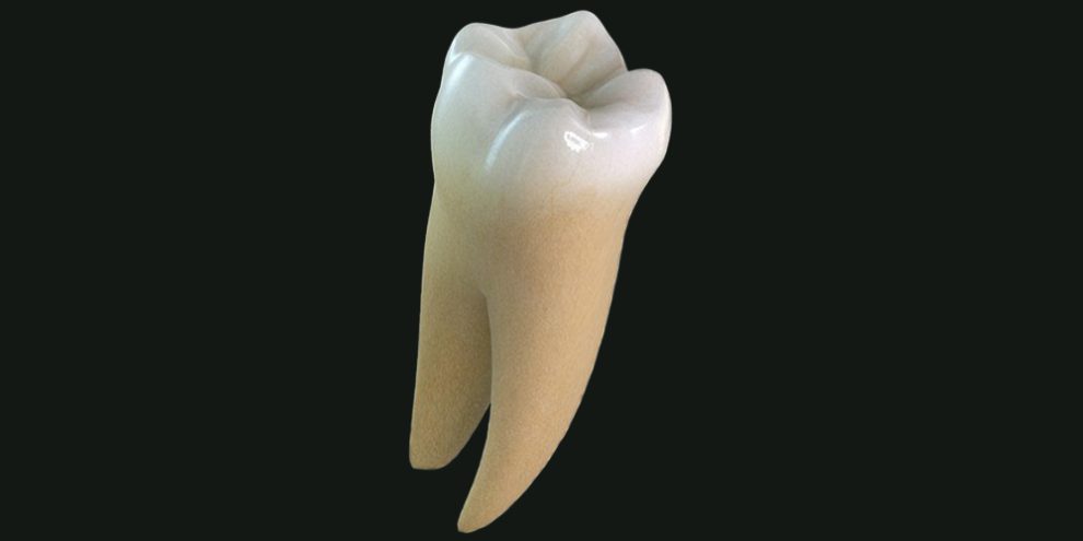 دندان عقل از نمای نزدیک