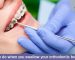 orthodontist placing bracket on woman teeth