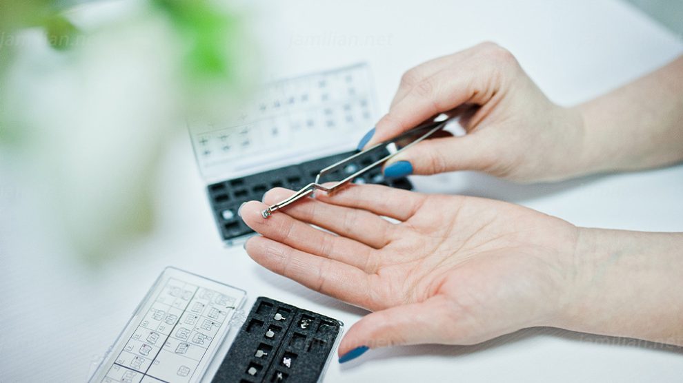 What to do when you swallow your orthodontic bracket? Dr Jamilian