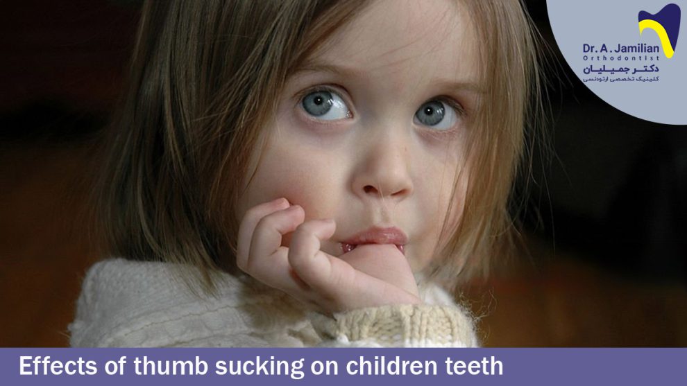 The Effects of Thumb Sucking on Children’s Teeth - Dr Jamilian