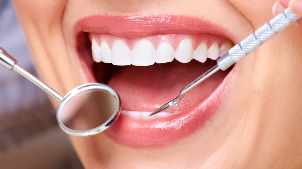 دندان جرم گیری شده بعد از درمان ارتودنسی