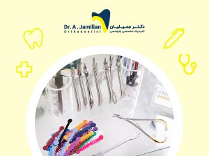 orthodontic tools and equipment on a glass table in orthodontic office