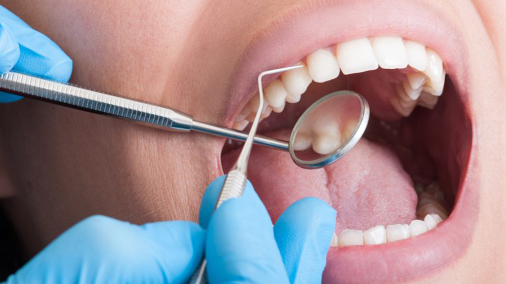 دندانپزشک در حال معاینه دندان