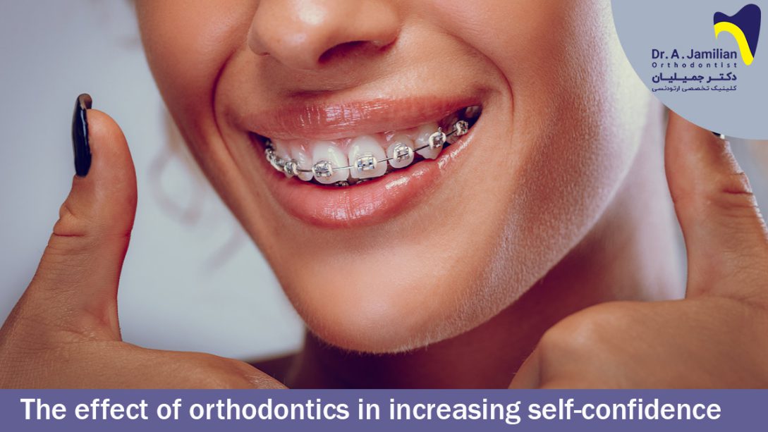 The Effect of Orthodontics on Improving Self-Confidence - Dr Jamilian