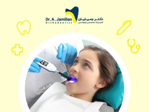 دندانپزشک در حال انجام فیشورسیلانت برای دندان کودک دختر