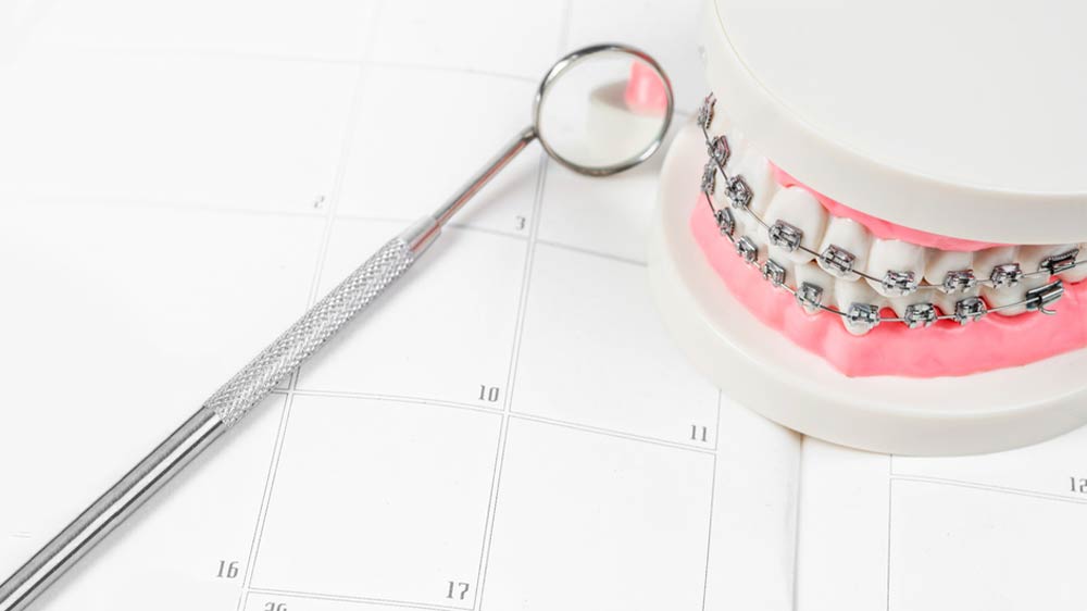Zahnnachbildung Zahnspange Dentalspiegel Terminkalender