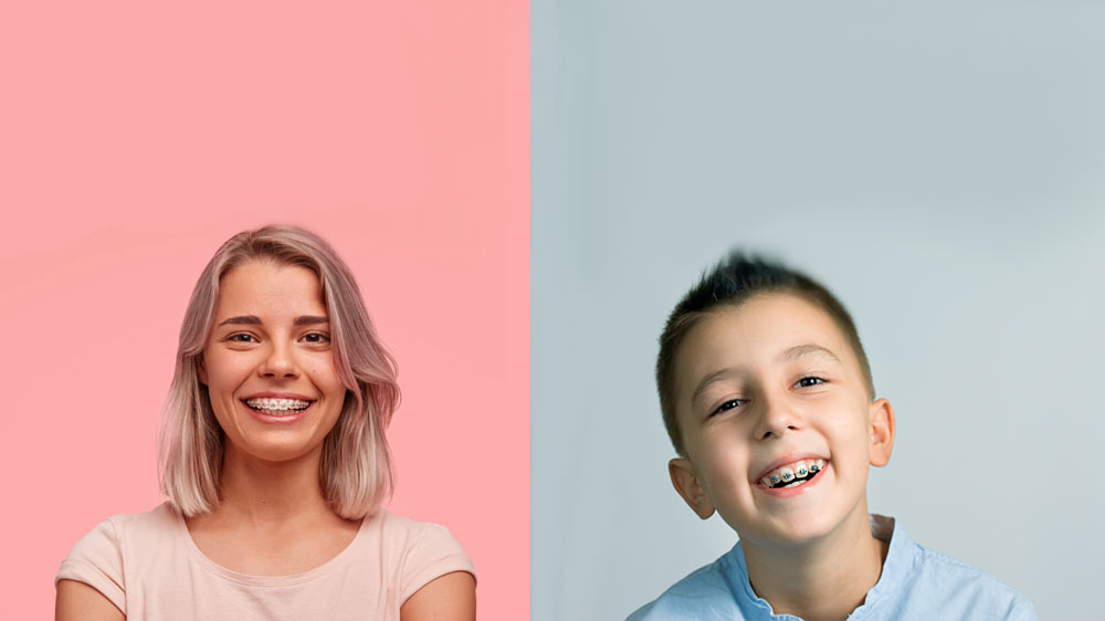 teenage boy and girl with orthodontic bracket on teeth