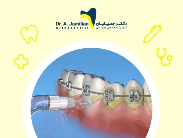 dental floss or waterpik