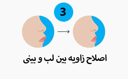 تاثیر ارتودنسی بر اصلاح ظاهر بینی و ایجاد هارمونی بین زاویه بین زاویه لب و بینی