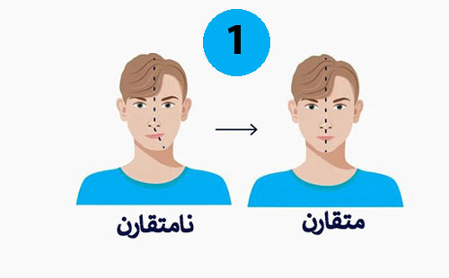 تاثیر ارتودنسی بر ایجاد هارمونی و تقارن فک و صورت و اصلاح تقارن اجزای صورت