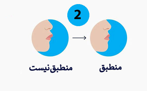 تاثیر ارتودنسی بر لب ها و انطباق آنها بعد از ارتودنسی