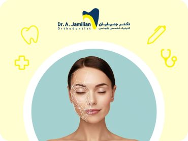 تاثیر ارتودنسی بر ظاهر فک و صورت بعد از انجام درمان ارتودنسی
