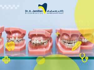 ناهنجاری های دندانی