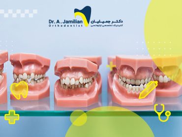 ناهنجاری های دندانی