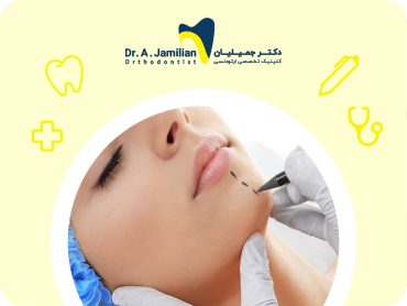 جراحی چانه و فک