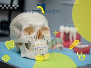 جوش خوردن فک بعد از عمل و جراحی چقدر زمان می برد