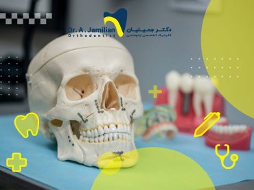 جوش خوردن فک بعد از عمل و جراحی چقدر زمان می برد