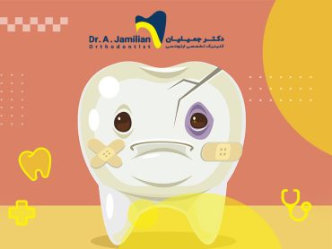ساییدگی دندان نیاز به درمان و ترمیم دارد