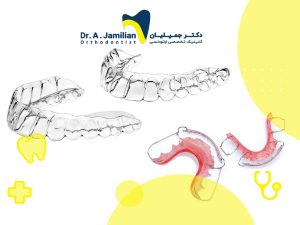 انواع مختلف از دستگاه های ارتودنسی متحرک