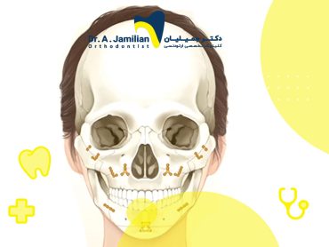 روش های جلوگیری از عوارض خطرناک جراحی فک و اسکلت جمجمه بیماری که تحت جراحی فک بالا و پایین قرار گرفته است