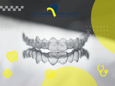 ارتودنسی نامرئی متحرک