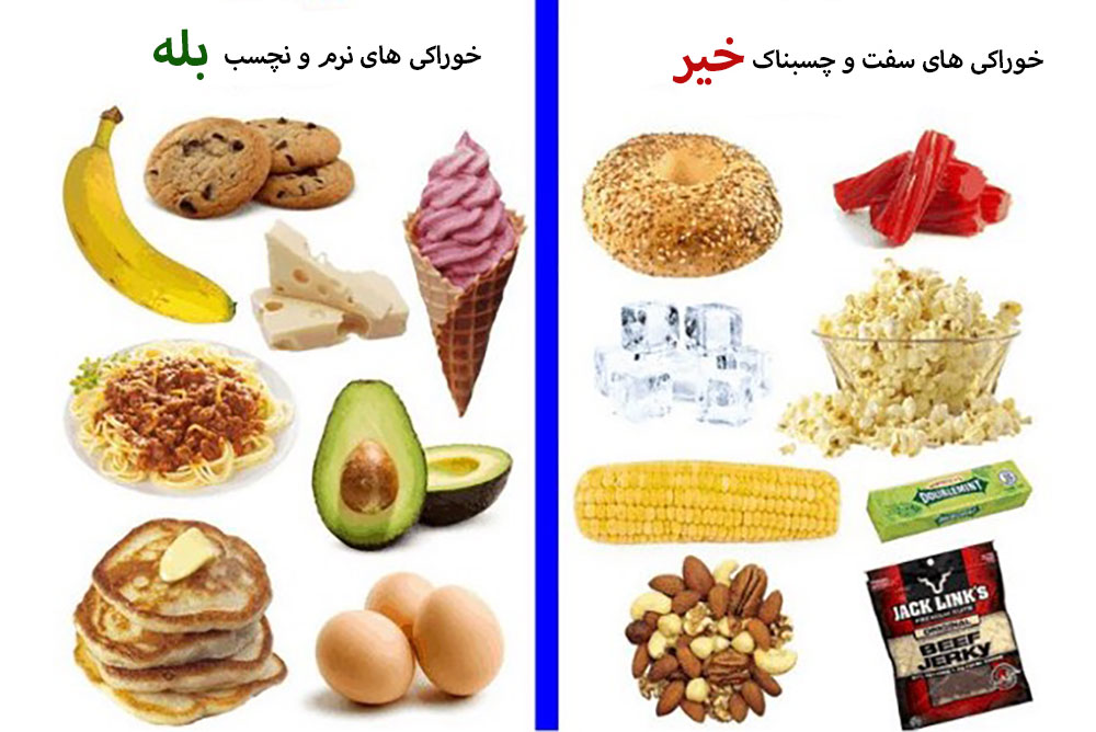 مقایسه خوراکی های مناسب و نامناسب دندان با ارتودنسی سرامیکی